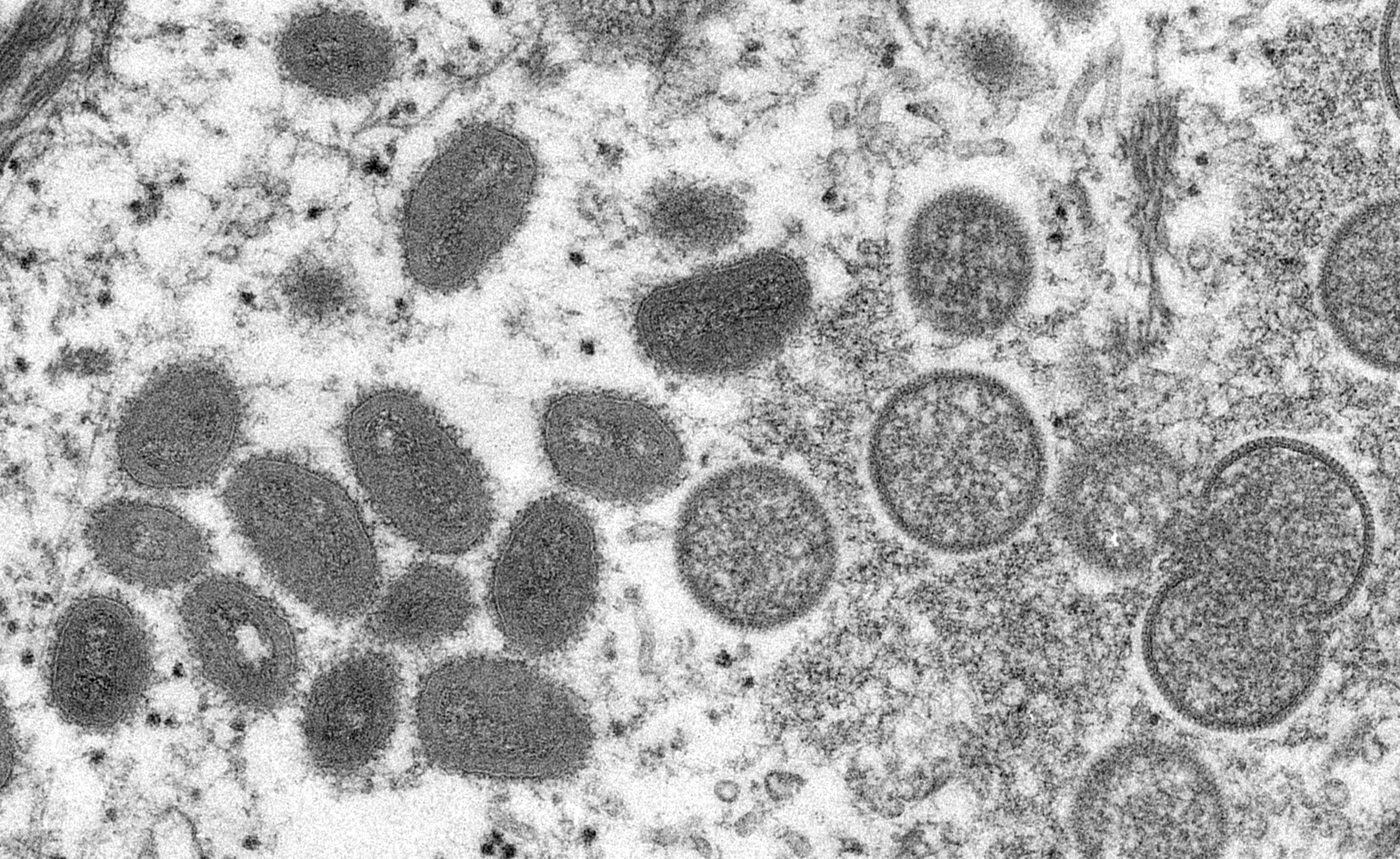 Monkeypox virus as seen under a mocroscope.
