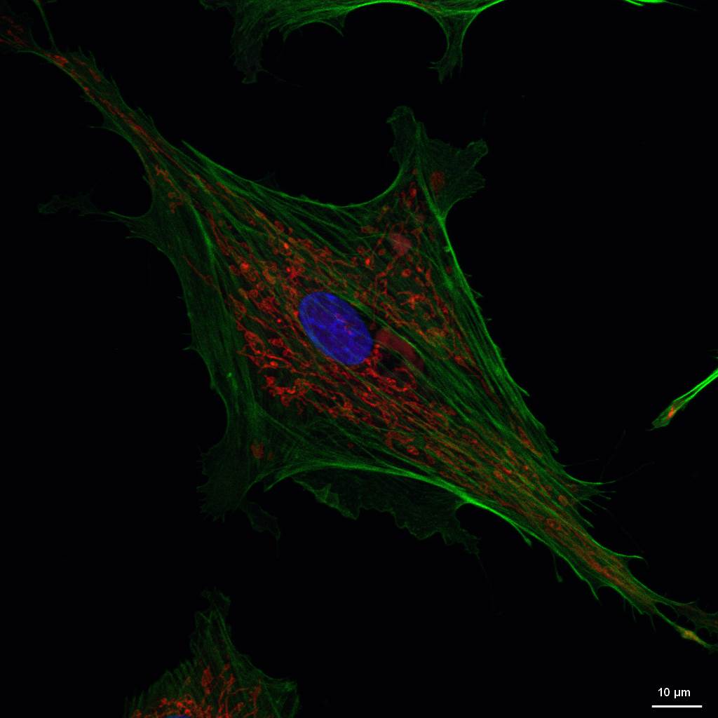 BPAE Cells, 60x oil lens, z-stacked micrograph