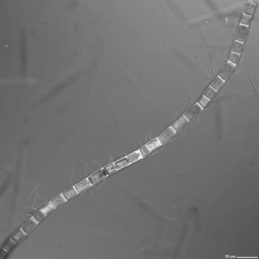 Mixed Diatoms, 20x magnification, DIC