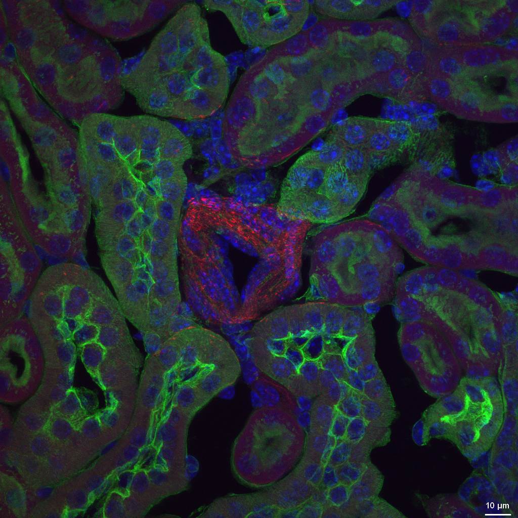 Mouse kidney section, 60x oil lens, z-stacked micrograph