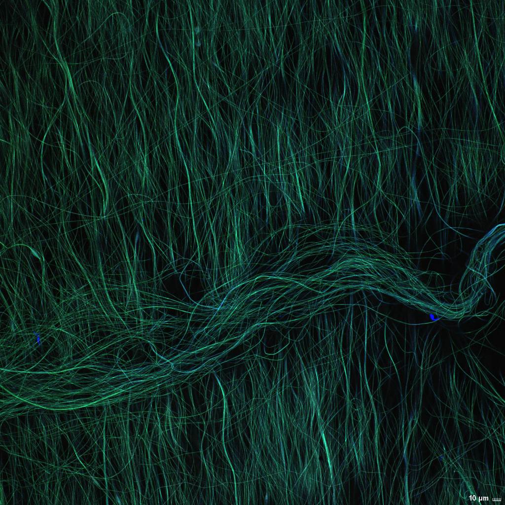 PAN Nanofibers - Irvin Lab - 20x magnification z-stacked micrograph