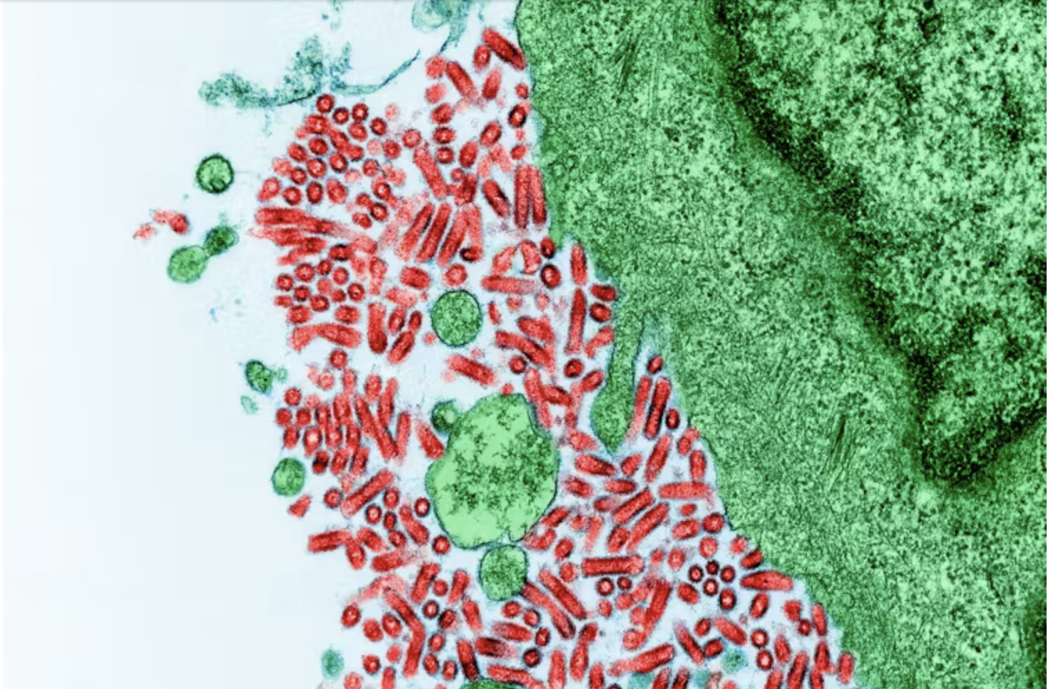 microscopic view of rabies virus