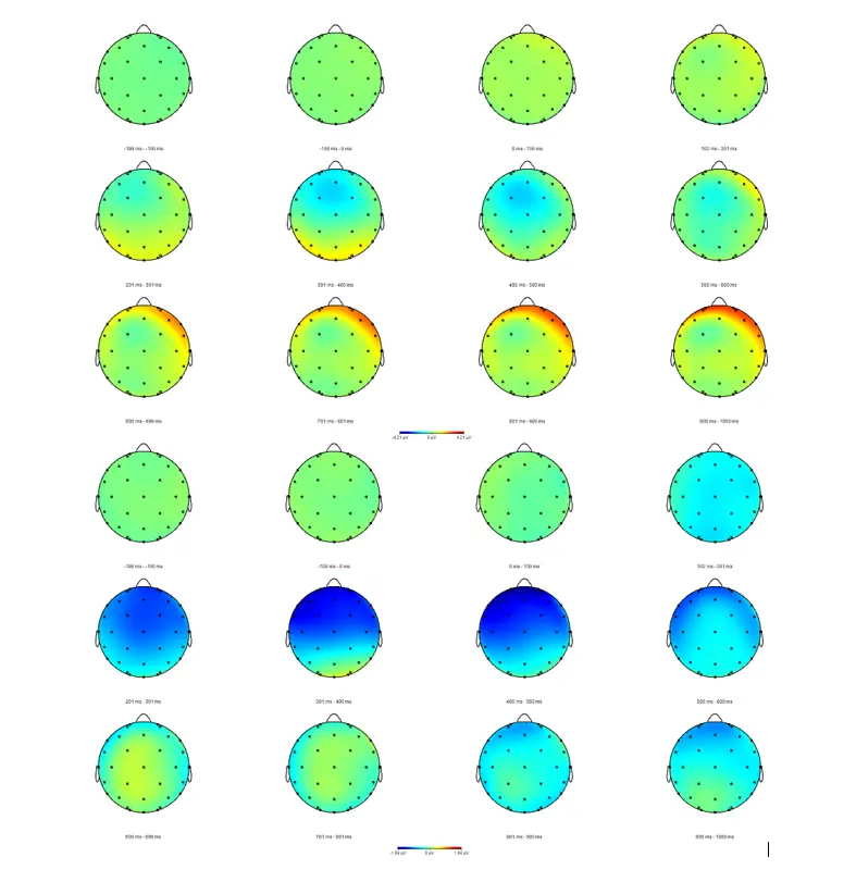 Constrained Hemisphere Aphasia Therapy