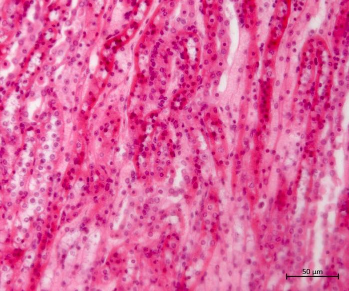 Transmitted Light Image of Kidney Section under 40X of Zeiss