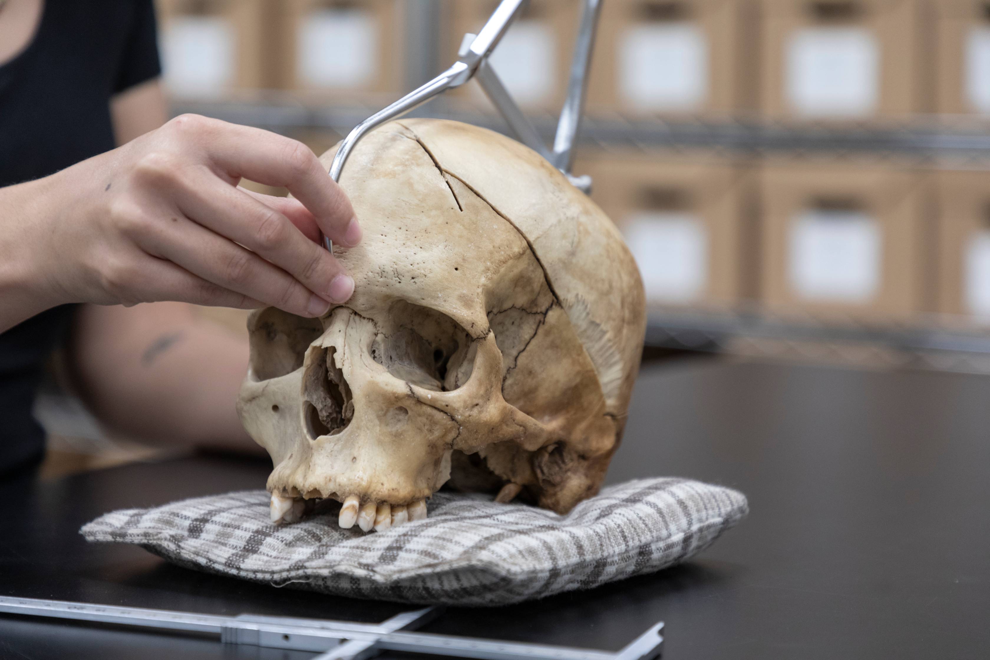 skull being inspected