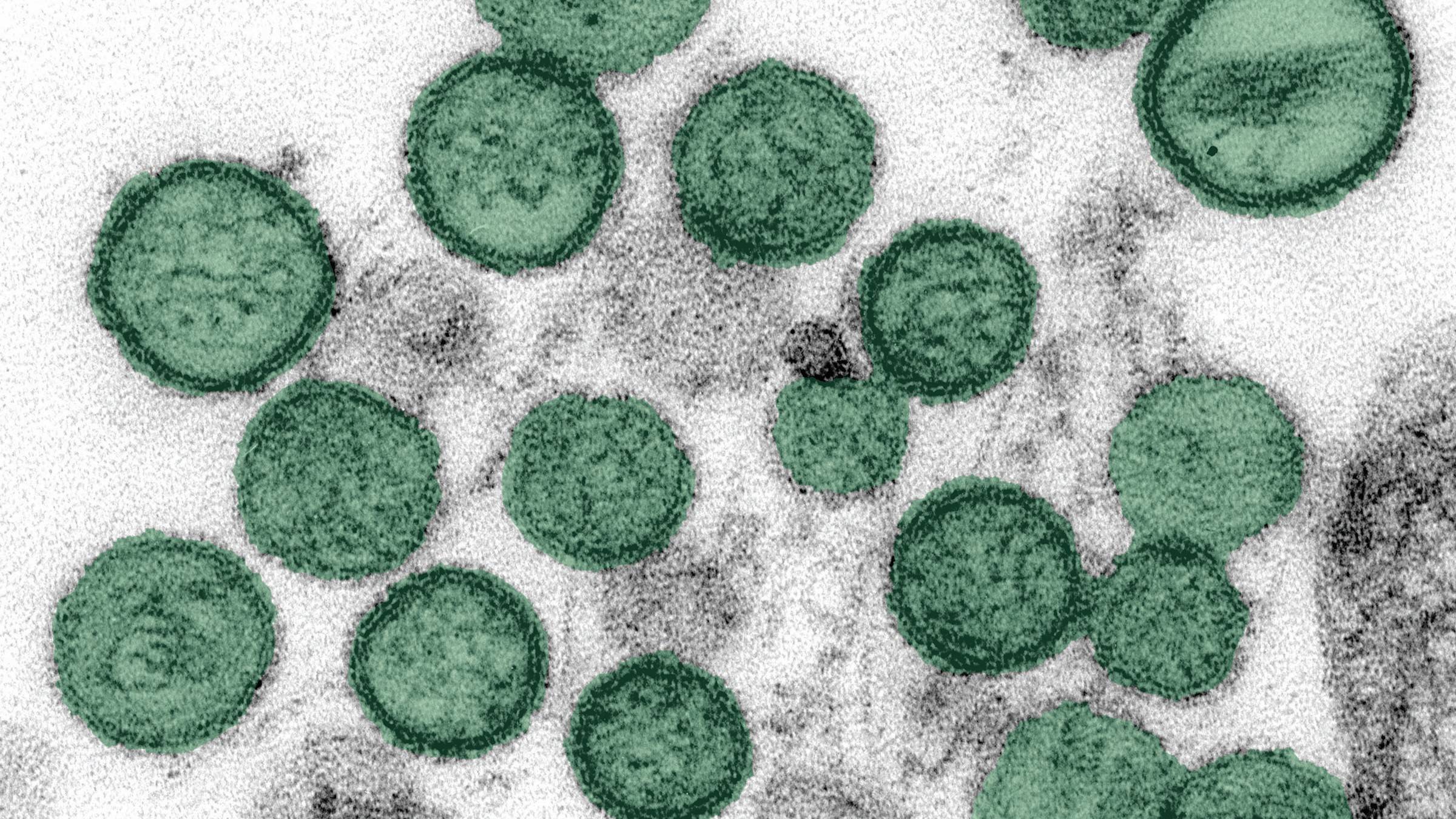 microscopic view of hantavirus