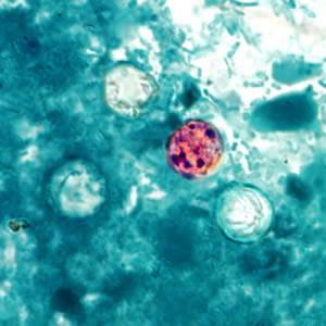colorized photo of cyclospora microbe