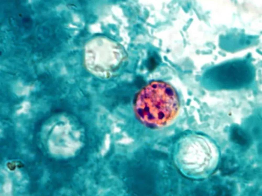 Microscopic image of a round, pink-orange stained parasite cell with several dark purple nuclei at its center, surrounded by pale circular structures on a blue-green background.