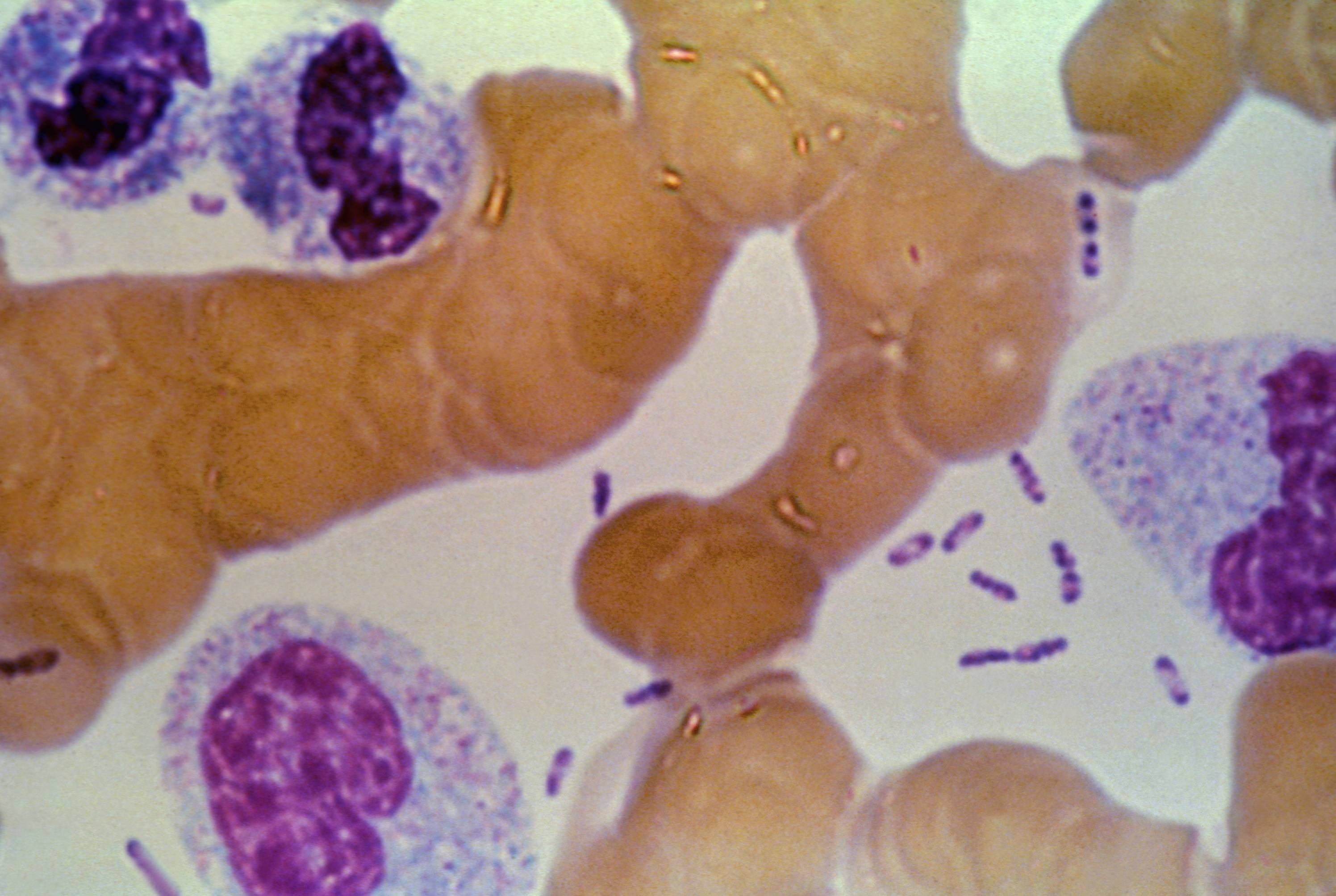 colorized photo of microscopic image 